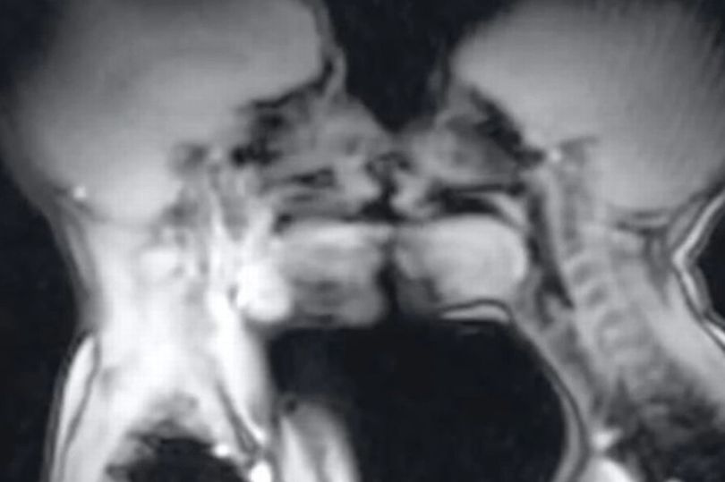Paar hat Sex im MRI-Scanner